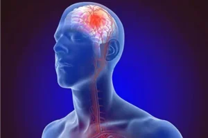 बार-बार मूड स्विंग? ये हो सकता है ‘साइलेंट स्ट्रोक’ का संकेत